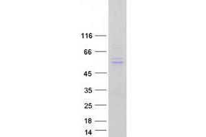 Validation with Western Blot