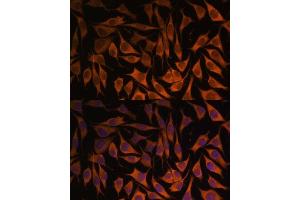 Immunofluorescence analysis of L929 cells using MRPS35 antibody (ABIN7268587) at dilution of 1:100.