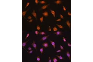 Immunofluorescence analysis of L929 cells using MB/MB/ML2 antibody (ABIN6132319, ABIN6143422, ABIN6143424 and ABIN6216232) at dilution of 1:100. (MAD2L2 anticorps  (AA 1-211))