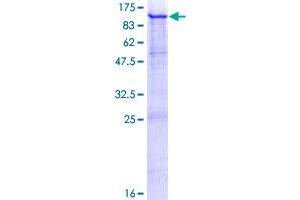 Image no. 1 for Premelanosome Protein (PMEL) (AA 1-661) protein (GST tag) (ABIN1320014)