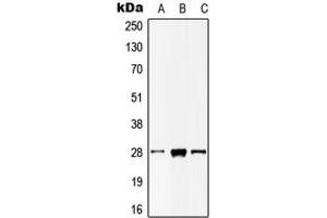 Western blot analysis of MOB2 expression in HepG2 (A), mouse liver (B), rat testis (C) whole cell lysates. (MOB2 anticorps  (N-Term))