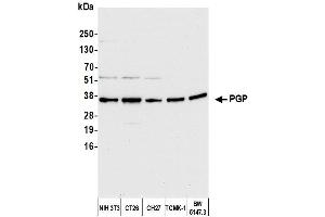 Western Blotting (WB) image for anti-Phosphoglycolate Phosphatase (PGP) (AA 271-321) antibody (ABIN7451551)
