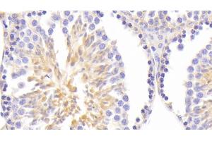 Detection of ASNS in Mouse Testis Tissue using Polyclonal Antibody to Asparagine Synthetase (ASNS) (Asparagine Synthetase anticorps  (AA 213-561))
