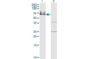 Western Blot analysis of ICAM1 expression in transfected 293T cell line by ICAM1 monoclonal antibody (M01), clone 3H8-2G6.