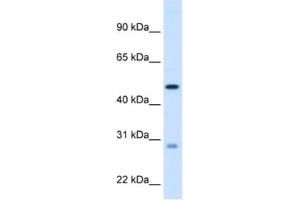 Western Blotting (WB) image for anti-Enoyl CoA Hydratase, Short Chain, 1, Mitochondrial (ECHS1) antibody (ABIN2462886) (ECHS1 anticorps)