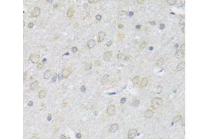 Immunohistochemistry of paraffin-embedded Rat brain using P2RX7 Polyclonal Antibody at dilution of 1:100 (40x lens). (P2RX7 anticorps)