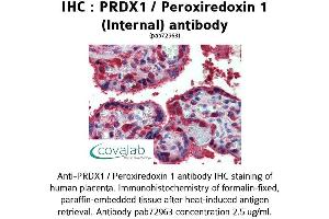Image no. 1 for anti-Peroxiredoxin 1 (PRDX1) (Internal Region) antibody (ABIN1738319) (Peroxiredoxin 1 anticorps  (Internal Region))