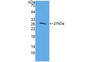 Western blot analysis of recombinant Human ELA3B.