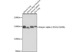 Western blot analysis of extracts of various cell lines, using Integrin alpha 2 (ITG/CD49b) (ITG/CD49b) antibody  at 1:1000 dilution. (ITGA2 anticorps)