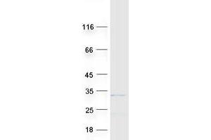 Validation with Western Blot