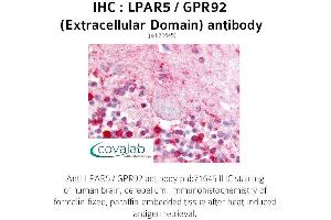 Image no. 1 for anti-Lysophosphatidic Acid Receptor 5 (LPAR5) (3rd Extracellular Domain) antibody (ABIN1736529)