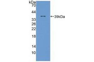 Detection of Recombinant ALOX12, Human using Polyclonal Antibody to Arachidonate-12-Lipoxygenase (ALOX12) (ALOX12 anticorps  (AA 352-656))