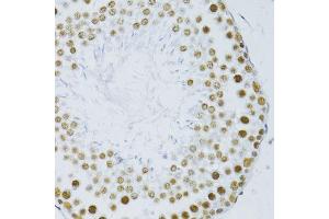Immunohistochemistry of paraffin-embedded rat testis using SNRNP70 antibody.