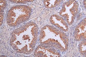 Immunohistochemistry of paraffin-embedded human kidney tissue using ABIN7158090 at dilution of 1:100 (LRRN3 anticorps  (AA 201-500))