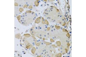 Immunohistochemistry of paraffin-embedded human stomach using ANAPC10 antibody at dilution of 1:100 (x40 lens). (ANAPC10 anticorps)