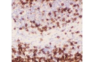 IHC-P staining of rat spleen tissue (CD3 epsilon anticorps  (AA 23-207))