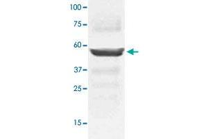 The tissue lysates derived from mouse liver were immunoblotted by MAP2K5 polyclonal antibody  at 1 : 1000. (MAP2K5 anticorps  (C-Term))