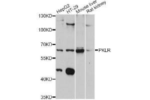 Western blot analysis of extracts of various cell lines, using PKLR antibody (ABIN5998532) at 1:3000 dilution. (PKLR anticorps)