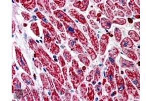 ABIN185194 (5µg/ml) staining of paraffin embedded Human Heart. (PIK3C2A anticorps  (C-Term))