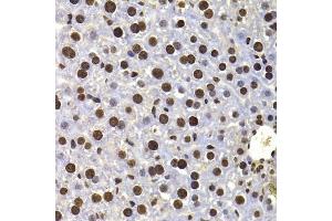 Immunohistochemistry of paraffin-embedded mouse liver using HIRIP3 antibody (ABIN6128019, ABIN6141779, ABIN6141780 and ABIN6222788) at dilution of 1:100 (40x lens).
