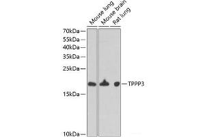 Western blot analysis of extracts of various cell lines using TPPP3 Polyclonal Antibody at dilution of 1:1000. (TPPP3 anticorps)