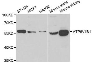 Western blot analysis of extracts of various cell lines, using ATP6V1B1 antibody. (ATP6V1B1 anticorps)