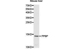 Western Blotting (WB) image for anti-Pro-Platelet Basic Protein (Chemokine (C-X-C Motif) Ligand 7) (PPBP) antibody (ABIN1874208) (CXCL7 anticorps)