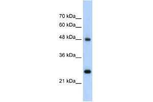 WB Suggested Anti-CHGA Antibody Titration:  5. (Chromogranin A anticorps  (N-Term))