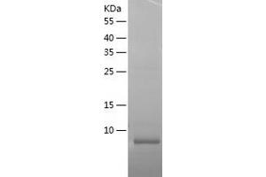 Western Blotting (WB) image for Chemokine (C-C Motif) Ligand 22 (CCL22) (AA 14-81) protein (His tag) (ABIN7122286) (CCL22 Protein (AA 14-81) (His tag))