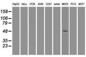 Image no. 2 for anti-Forkhead Box A1 (FOXA1) antibody (ABIN1498292) (FOXA1 anticorps)