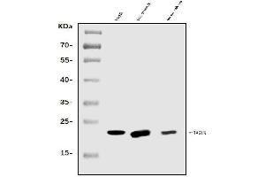 Western blot analysis of TAGLN/Transgelin using anti-TAGLN/Transgelin antibody (ABIN7600099).