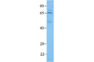 Host:  Rabbit  Target Name:  MEIS2  Sample Type:  T-OV (Tumor-Ovary)  Antibody Dilution:  3. (MEIS2 anticorps  (N-Term))