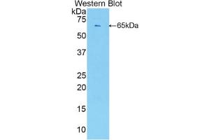 Western blot analysis of the recombinant protein. (ESM1 anticorps  (AA 22-184))