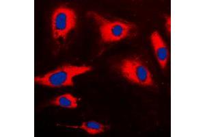 Immunofluorescent analysis of CARD14 staining in HeLa cells. (CARD14 anticorps  (Center))