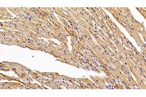 Detection of HIF1a in Rat Cardiac Muscle Tissue using Polyclonal Antibody to Hypoxia Inducible Factor 1 Alpha (HIF1a) (HIF1A anticorps  (AA 216-336))