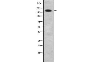 Western blot analysis of ABCC9 using HeLa whole cell lysates (ABCC9 anticorps  (C-Term))
