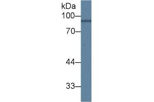 Detection of ANG in Mouse Brain lysate using Polyclonal Antibody to Angiostatin (ANG)