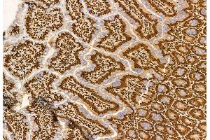 ABIN6259966 and ABIN6272936 at 1/100 staining Rat colon tissue by IHC-P. (AP3B1 anticorps  (C-Term))