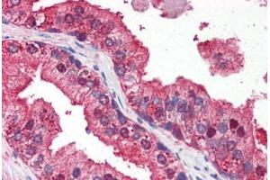 Human Prostate (formalin-fixed, paraffin-embedded) stained with DRAM antibody ABIN351449 at 3 ug/ml followed by biotinylated goat anti-rabbit IgG secondary antibody ABIN481713, alkaline phosphatase-streptavidin and chromogen. (DRAM anticorps  (N-Term))