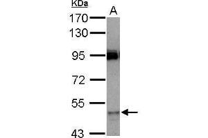 WB Image Sample (30 ug of whole cell lysate) A: HeLa 7.