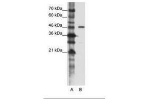 Image no. 1 for anti-Protein Phosphatase 1, Regulatory Subunit 8 (PPP1R8) (AA 91-140) antibody (ABIN202315) (PPP1R8 anticorps  (AA 91-140))