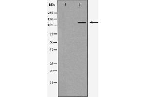 Western blot analysis of Integrin αE expression in HepG2 cells,The lane on the left is treated with the antigen-specific peptide. (CD103 anticorps  (N-Term))