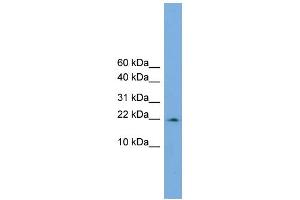 WB Suggested Anti-PPIL3  Antibody Titration: 0. (PPIL3 anticorps  (Middle Region))