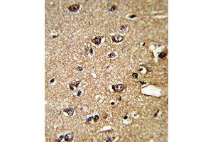 Immunohistochemistry (IHC) image for anti-Peptidylprolyl Isomerase A (Cyclophilin A) (PPIA) antibody (ABIN3001732) (PPIA anticorps)