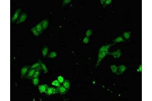 anti-FAT Tumor Suppressor Homolog 3 (FAT3) (AA 1209-1470) antibody