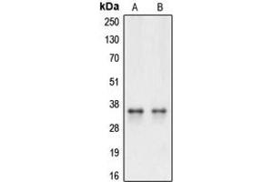 Western blot analysis of Caspase 3 expression in HeLa (A), Raw264. (Caspase 3 anticorps  (Center))
