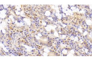 Detection of GIP in Human Small intestine Tissue using Polyclonal Antibody to Gastric Inhibitory Polypeptide (GIP)