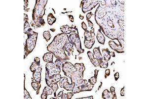IHC analysis of DLAT using anti-DLAT antibody (ABIN7602307). (DLAT anticorps  (AA 69-642))