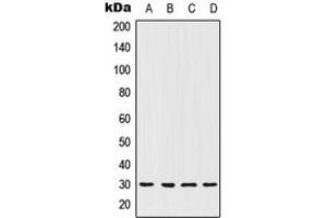 Western blot analysis of HOXC12 expression in MCF7 (A), ACHN (B), NIH3T3 (C), PC12 (D) whole cell lysates. (HOXC12 anticorps  (Center))