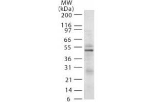 Image no. 1 for anti-E3 ubiquitin-protein ligase RAD18 (RAD18) (AA 402-414) antibody (ABIN208024) (RAD18 anticorps  (AA 402-414))